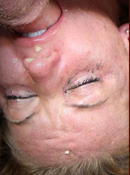 Facial Abuse Destroys Ivy Monroe